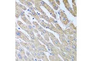 Immunohistochemistry of paraffin-embedded human liver using FUT6 antibody at dilution of 1:100 (40x lens). (FUT6 anticorps)