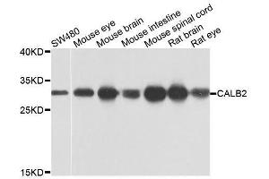 Western blot analysis of extracts of various cell lines, using CALB2 antibody. (Calretinin anticorps  (AA 1-271))