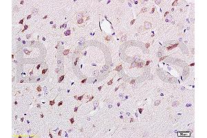 Formalin-fixed and paraffin embedded rat brain tissue labeled Anti-NF-H/Neurofilament H/Neurofilament 200 Polyclonal Antibody (ABIN672156), Unconjugated at 1:200, followed by conjugation to the secondary antibody and DAB staining (NEFH anticorps  (AA 1-100))