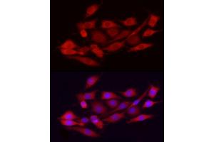Immunofluorescence analysis of PC-12 cells using EXT1 Rabbit pAb (ABIN3022736, ABIN3022737, ABIN3022738 and ABIN6219202) at dilution of 1:100 (40x lens).