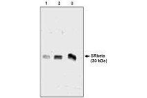 Western blot analysis  using SRβ antibody  ng  of canine microsomal protein  Chicken, Dog (SRPRB anticorps  (AA 246-265))