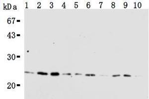 Western Blotting (WB) image for anti-RAN, Member RAS Oncogene Family (RAN) antibody (ABIN1449197) (RAN anticorps)