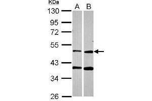 WB Image Sample (30 ug of whole cell lysate) A: A549 B: HCT116 10% SDS PAGE antibody diluted at 1:2000 (PPOX anticorps)