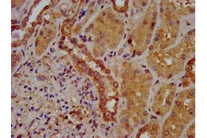 IHC image of ABIN7170211 diluted at 1:400 and staining in paraffin-embedded human kidney tissue performed on a Leica BondTM system. (SLC26A6 anticorps  (AA 554-668))