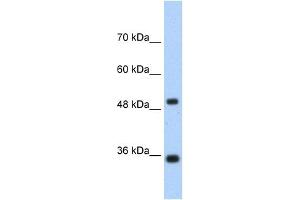 WB Suggested Anti-FBP1 Antibody  Titration: 1. (FBP1 anticorps  (N-Term))