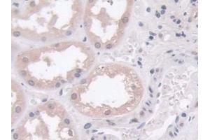 Detection of PLD in Human Kidney Tissue using Polyclonal Antibody to Phospholipase D (PLD)