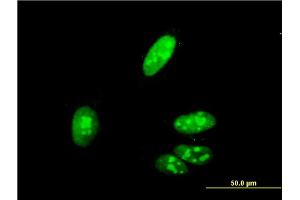 Immunofluorescence of monoclonal antibody to ZIC4 on HeLa cell. (ZIC4 anticorps  (AA 249-319))