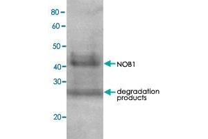 Detection of RPN7 (51. (NOB1 anticorps)