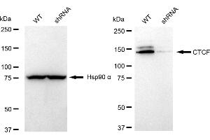 Western blotting analysis using CTCF antibody (ABIN7797950).