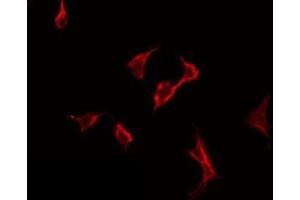 anti-Phospholipase A2, Group VI (Cytosolic, Calcium-Independent) (PLA2G6) (Internal Region) antibody