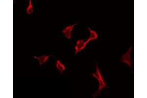 ABIN6275784 staining HeLa by IF/ICC. (PLA2G6 anticorps  (Internal Region))