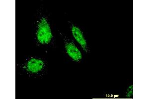 Immunofluorescence of monoclonal antibody to RHOXF1 on HeLa cell. (RHOXF1 anticorps  (AA 1-110))
