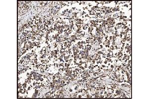 IHC analysis of FABP-1/GOT2 using anti-FABP-1/GOT2 antibody (ABIN7601426). (GOT2 anticorps  (AA 35-430))