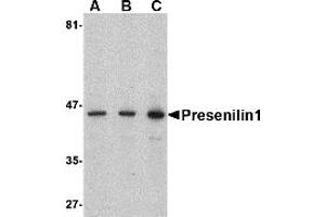 Western Blotting (WB) image for anti-Presenilin 1 (PSEN1) (C-Term) antibody (ABIN1030600) (Presenilin 1 anticorps  (C-Term))
