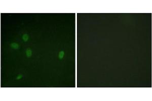 Immunofluorescence analysis of NIH/3T3 cells, using 53BP1 (Phospho-Ser25) antibody. (TP53BP1 anticorps  (pSer25))