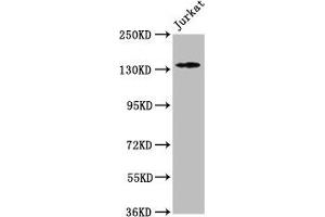 Western Blot Positive WB detected in: Jurkat whole cell lysate All lanes: ATP2B3 antibody at 1:500 Secondary Goat polyclonal to rabbit IgG at 1/50000 dilution Predicted band size: 135, 129, 128, 133, 127, 125, 123 kDa Observed band size: 135 kDa (ATP2B3 anticorps  (AA 1057-1220))