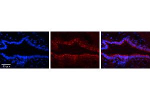 Rabbit Anti-FOXK2 Antibody     Formalin Fixed Paraffin Embedded Tissue: Human Bronchial Epithelial Tissue  Observed Staining: Nuclear in perinuclear/nuclear Membrane  Primary Antibody Concentration: 1:100  Other Working Concentrations: 1/600  Secondary Antibody: Donkey anti-Rabbit-Cy3  Secondary Antibody Concentration: 1:200  Magnification: 20X  Exposure Time: 0.