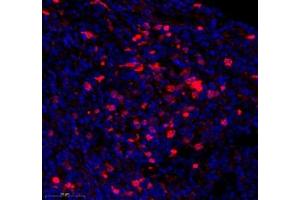 Immunofluorescence of paraffin embedded human tonsil using DCR3 (ABIN7076071) at dilution of 1: 700 (350x lens)
