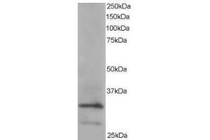 Image no. 1 for anti-Actin Related Protein 2/3 Complex, Subunit 2, 34kDa (ARPC2) (C-Term) antibody (ABIN374215) (ARPC2 anticorps  (C-Term))