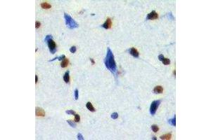 Immunohistochemical analysis of RING1b staining in mouse brain formalin fixed paraffin embedded tissue section.