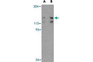 Western blot analysis of FYB in K-562 cell lysate with FYB polyclonal antibody  at (A) 0. (FYB anticorps  (C-Term))