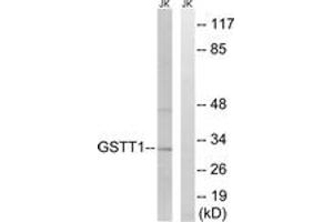 Western blot analysis of extracts from Jurkat cells, using GSTT1/4 Antibody. (GSTT1/4 anticorps  (AA 10-59))