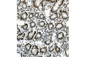IHC analysis of SORBS3 using anti-SORBS3 antibody (ABIN7603121).