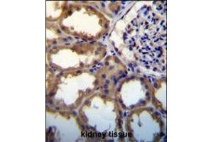 PDGFC antibody immunohistochemistry analysis in formalin fixed and paraffin embedded human kidney tissue followed by peroxidase conjugation of the secondary antibody and DAB staining.