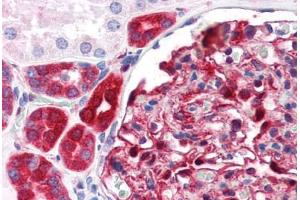 Human Kidney (formalin-fixed, paraffin-embedded) stained with NQO1 antibody ABIN364280 at 1:100 followed by biotinylated anti-mouse IgG secondary antibody ABIN481714, alkaline phosphatase-streptavidin and chromogen. (NQO1 anticorps)