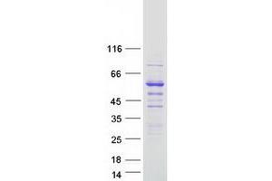 Validation with Western Blot