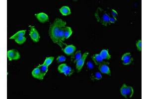 Immunofluorescent analysis of MCF-7 cells using ABIN7177361 at dilution of 1:100 and Alexa Fluor 488-congugated AffiniPure Goat Anti-Rabbit IgG(H+L)
