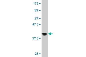 Western Blot detection against Immunogen (37. (ZNF274 anticorps  (AA 420-530))