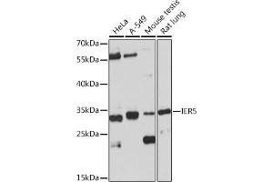 Western blot analysis of extracts of various cell lines, using IER5 Rabbit pAb (ABIN7267843) at 1:1000 dilution. (IER5 anticorps)