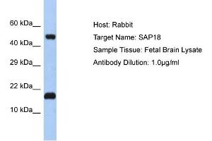 Host: Rabbit Target Name: SAP18 Sample Tissue: Human Fetal Brain Antibody Dilution: 1ug/ml (SAP18 anticorps  (N-Term))