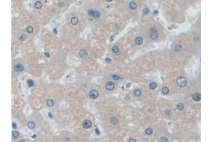 Detection of IDE in Human Liver Tissue using Polyclonal Antibody to Insulin Degrading Enzyme (IDE)