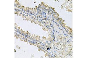Immunohistochemistry of paraffin-embedded human prostate using PPIC antibody at dilution of 1:100 (x40 lens). (PPIC anticorps)