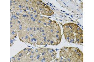 Immunohistochemistry of paraffin-embedded Human stomach using THBS2 Polyclonal Antibody at dilution of 1:100 (40x lens). (Thrombospondin 2 anticorps)