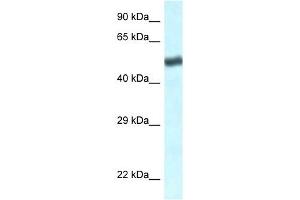 Western Blot showing TBL1XR1 antibody used at a concentration of 1 ug/ml against Jurkat Cell Lysate (TBL1XR1 anticorps  (C-Term))