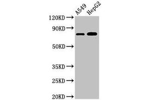 Western Blot Positive WB detected in: A549 whole cell lysate, HepG2 whole cell lysate All lanes: TBC1D15 antibody at 3 μg/mL Secondary Goat polyclonal to rabbit IgG at 1/50000 dilution Predicted band size: 80, 78, 79 kDa Observed band size: 80 kDa (TBC1D15 anticorps  (AA 283-404))