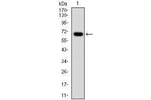 Western blot analysis using G6PD mAb against human G6PD (AA: 275-515) recombinant protein.