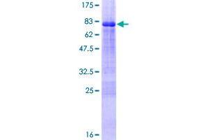 Image no. 1 for Zinc Finger Protein 239 (ZNF239) (AA 1-458) protein (GST tag) (ABIN1326013)