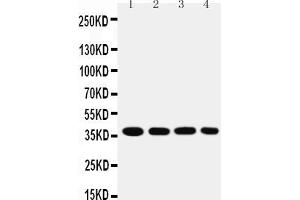 Anti-MTCO1 antibody, Western blotting Lane 1: SMMC Cell Lysate Lane 2: MCF-7 Cell Lysate Lane 3: RAJI Cell Lysate Lane 4: SW620 Cell Lysate (COX1 anticorps  (C-Term))