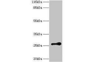 Western blot All lanes: RAB3C antibody at 2 μg/mL + Mouse brain tissue Secondary Goat polyclonal to rabbit IgG at 1/10000 dilution Predicted band size: 26 kDa Observed band size: 26 kDa (Rab3c anticorps  (AA 1-227))