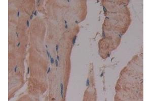 Detection of GLUD1 in Mouse Skeletal muscle Tissue using Polyclonal Antibody to Glutamate Dehydrogenase 1 (GLUD1) (GLUD1 anticorps  (AA 65-273))