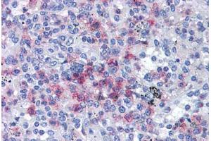 Human Spleen: Formalin-Fixed, Paraffin-Embedded (FFPE)