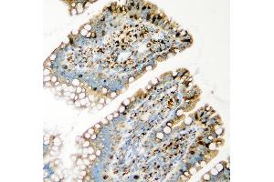 IHC analysis of GLB1 using anti-GLB1 antibody (ABIN7599649). (GLB1 anticorps  (AA 103-646))