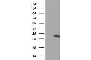 Western Blotting (WB) image for anti-Hes Family bHLH Transcription Factor 1 (HES1) antibody (ABIN1498636)