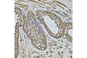 Immunohistochemistry of paraffin-embedded human prostate using CPOX antibody. (CPOX anticorps  (AA 111-454))