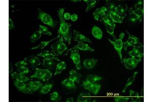 Immunofluorescence of monoclonal antibody to ACBD3 on HeLa cell.