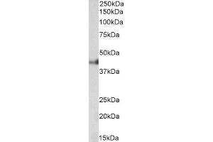 ABIN4902686 (0. (Cytokeratin 18 anticorps)